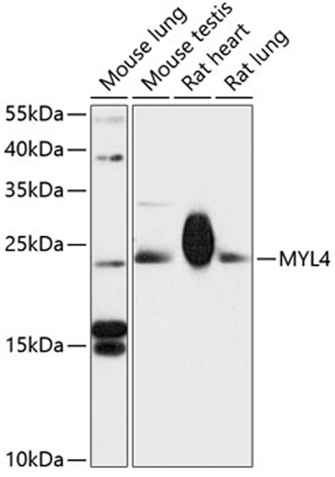 Western blot - MYL4 antibody (A13249)