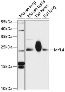 Western blot - MYL4 antibody (A13249)