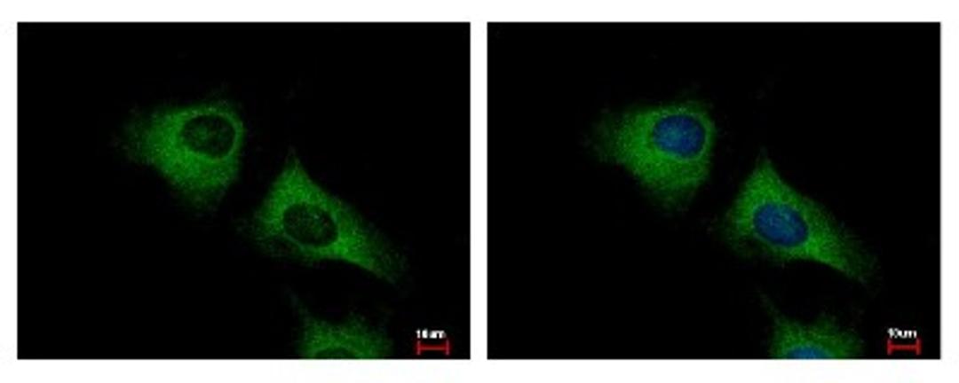 Immunocytochemistry/Immunofluorescence: SCARA3 Antibody [NBP1-32130] - Sample: HeLa cells were fixed in -20C 100% MeOH for 5 min. Green: SCARA3 protein stained by SCARA3 antibody, Internal diluted at 1:500. Blue: Hoechst 33343 staining.