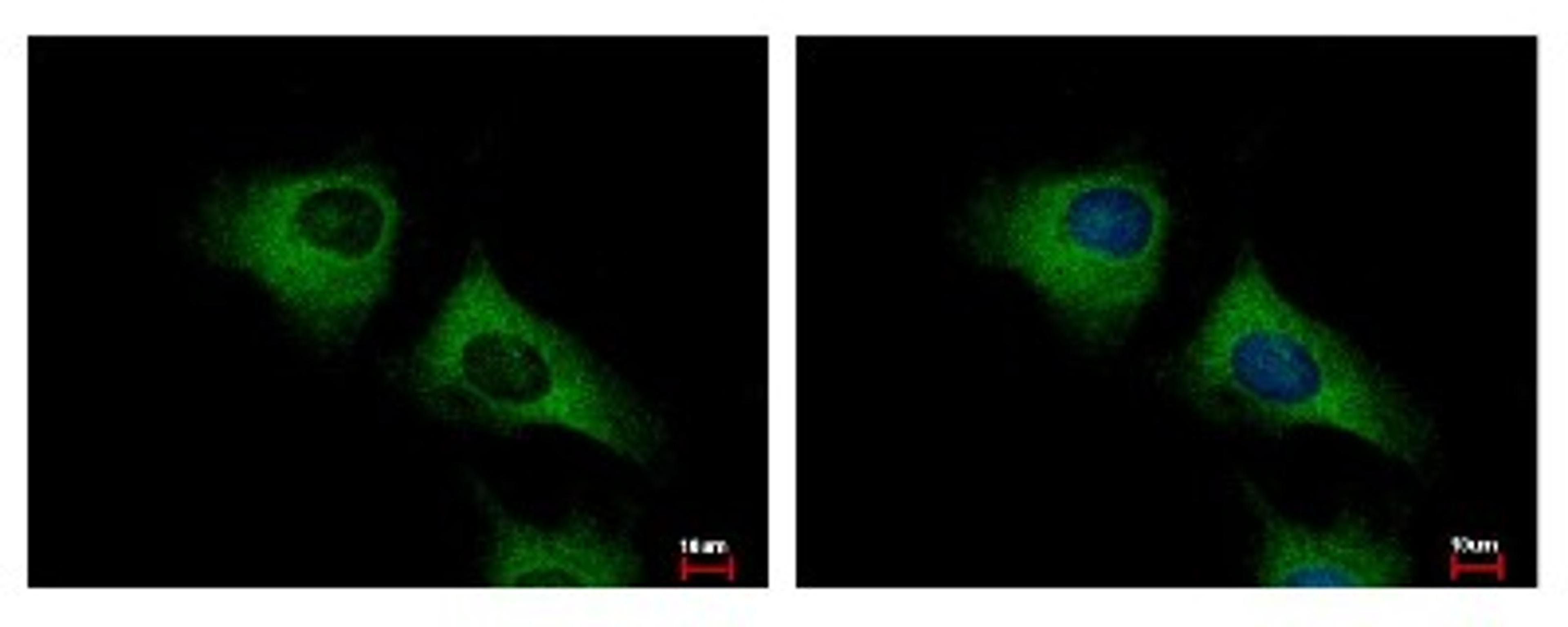 Immunocytochemistry/Immunofluorescence: SCARA3 Antibody [NBP1-32130] - Sample: HeLa cells were fixed in -20C 100% MeOH for 5 min. Green: SCARA3 protein stained by SCARA3 antibody, Internal diluted at 1:500. Blue: Hoechst 33343 staining.