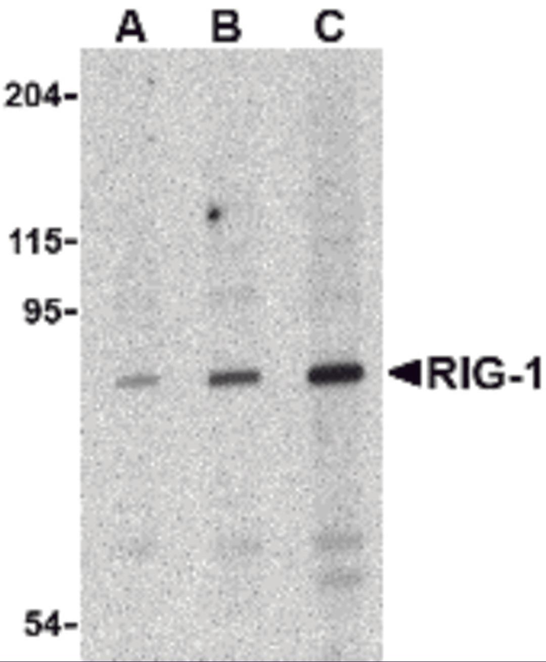 Western blot analysis of RIG-1 in C2C12 cell lysate with RIG-1 antibody at (A) 0.5, (B) 1 and (C) 2 &#956;g/mL.