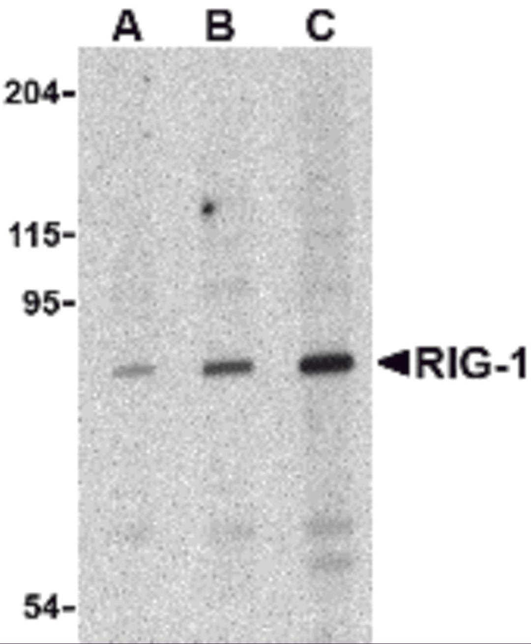 Western blot analysis of RIG-1 in C2C12 cell lysate with RIG-1 antibody at (A) 0.5, (B) 1 and (C) 2 μg/mL.