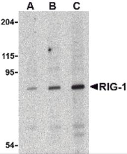 Western blot analysis of RIG-1 in C2C12 cell lysate with RIG-1 antibody at (A) 0.5, (B) 1 and (C) 2 μg/mL.