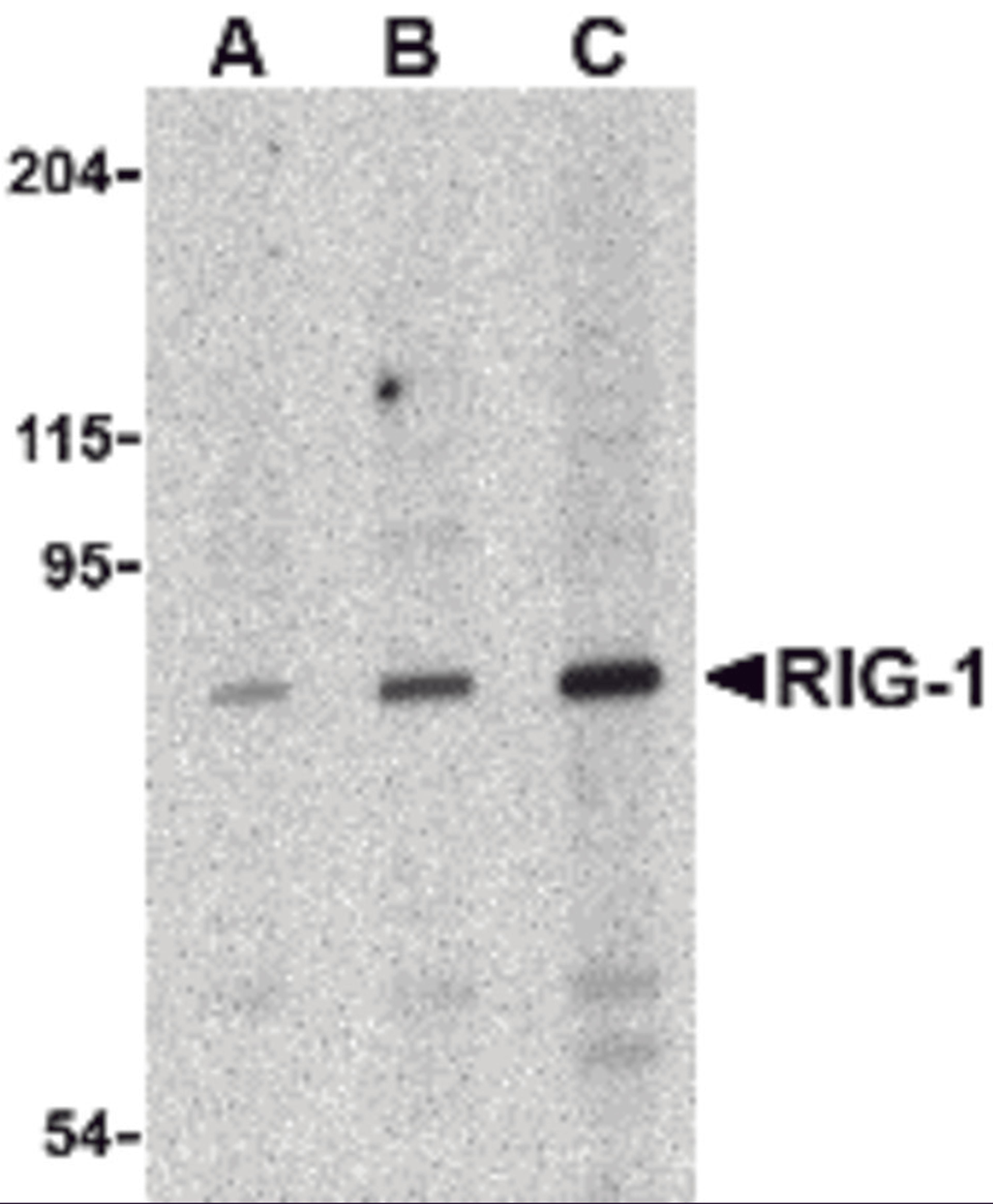 Western blot analysis of RIG-1 in C2C12 cell lysate with RIG-1 antibody at (A) 0.5, (B) 1 and (C) 2 μg/mL.