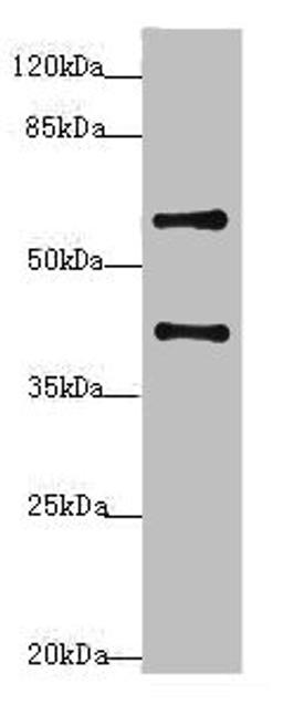 Western blot. All lanes: SYCE1 antibody at 3.38ug/ml + Mouse liver tissue. Secondary. Goat polyclonal to rabbit IgG at 1/10000 dilution. Predicted band size: 40, 33, 22 kDa. Observed band size: 40, 58 kDa. 