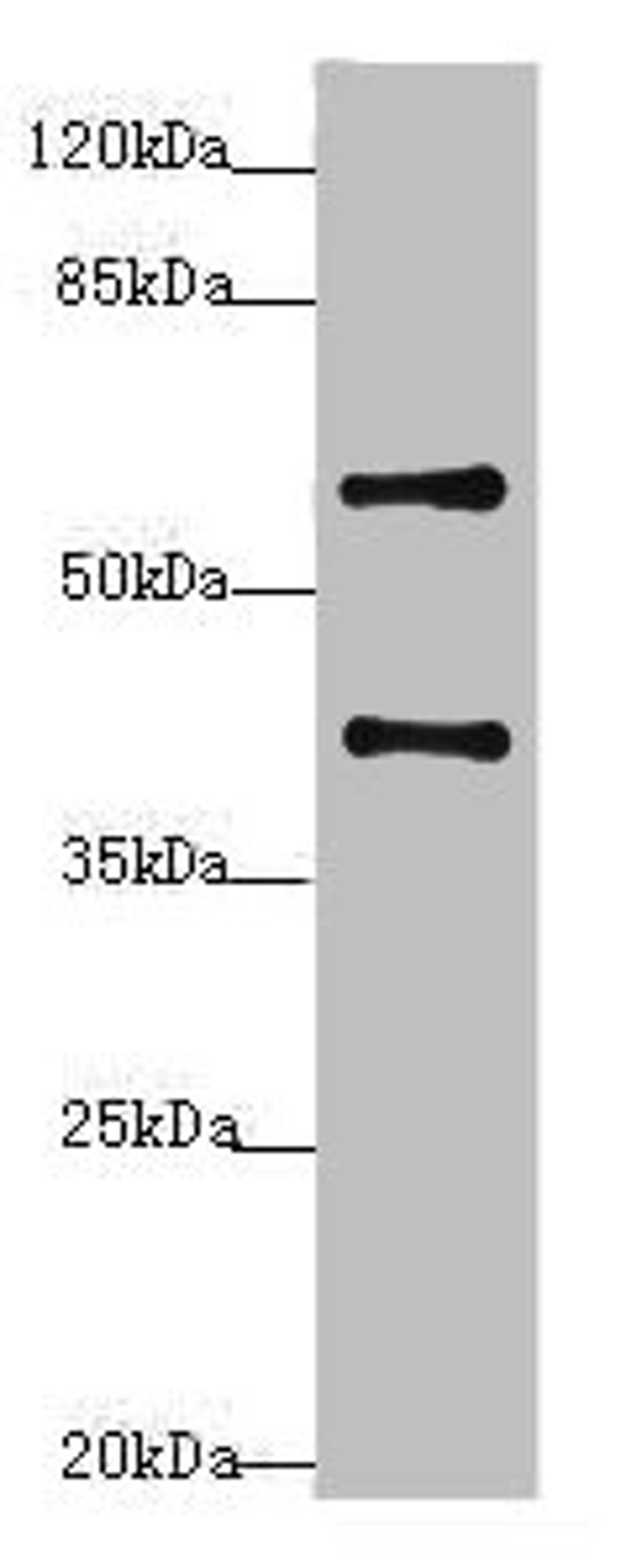 Western blot. All lanes: SYCE1 antibody at 3.38ug/ml + Mouse liver tissue. Secondary. Goat polyclonal to rabbit IgG at 1/10000 dilution. Predicted band size: 40, 33, 22 kDa. Observed band size: 40, 58 kDa. 