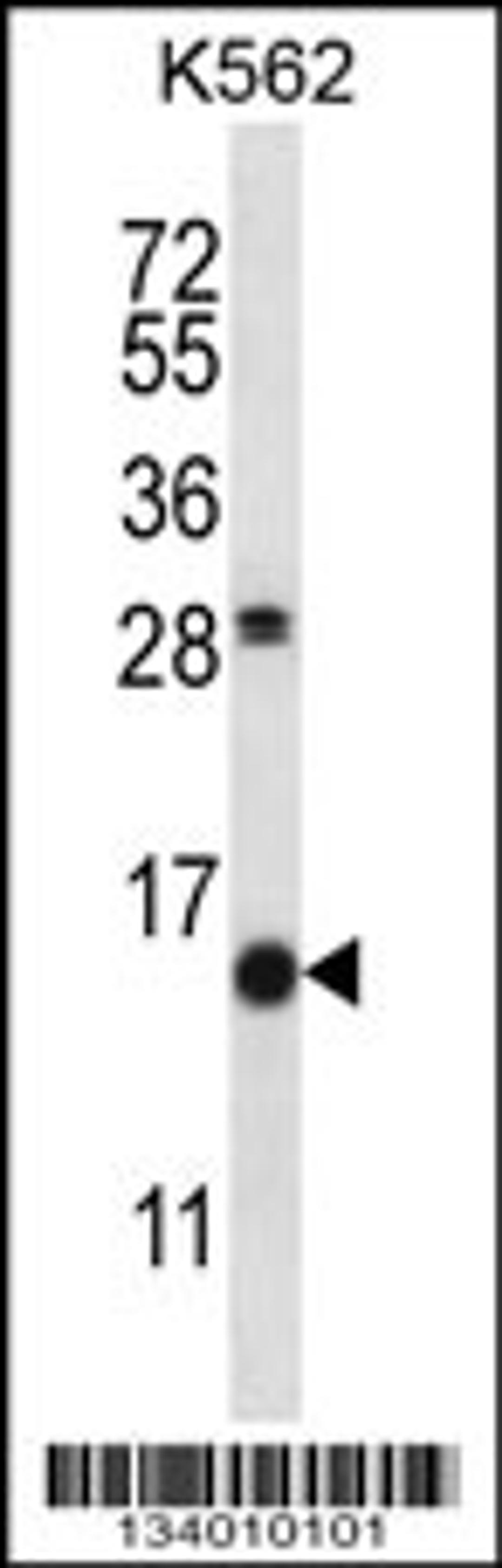 Western blot analysis in K562 cell line lysates (35ug/lane).