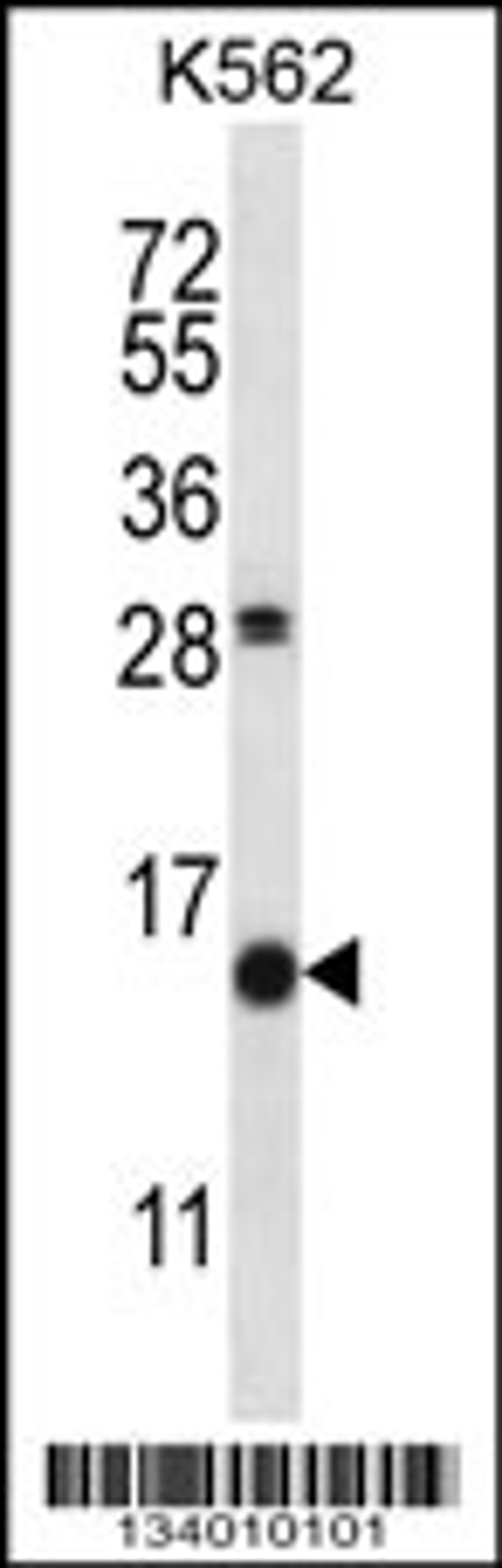 Western blot analysis in K562 cell line lysates (35ug/lane).