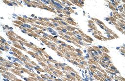 Antibody used in IHC on Human Muscle.