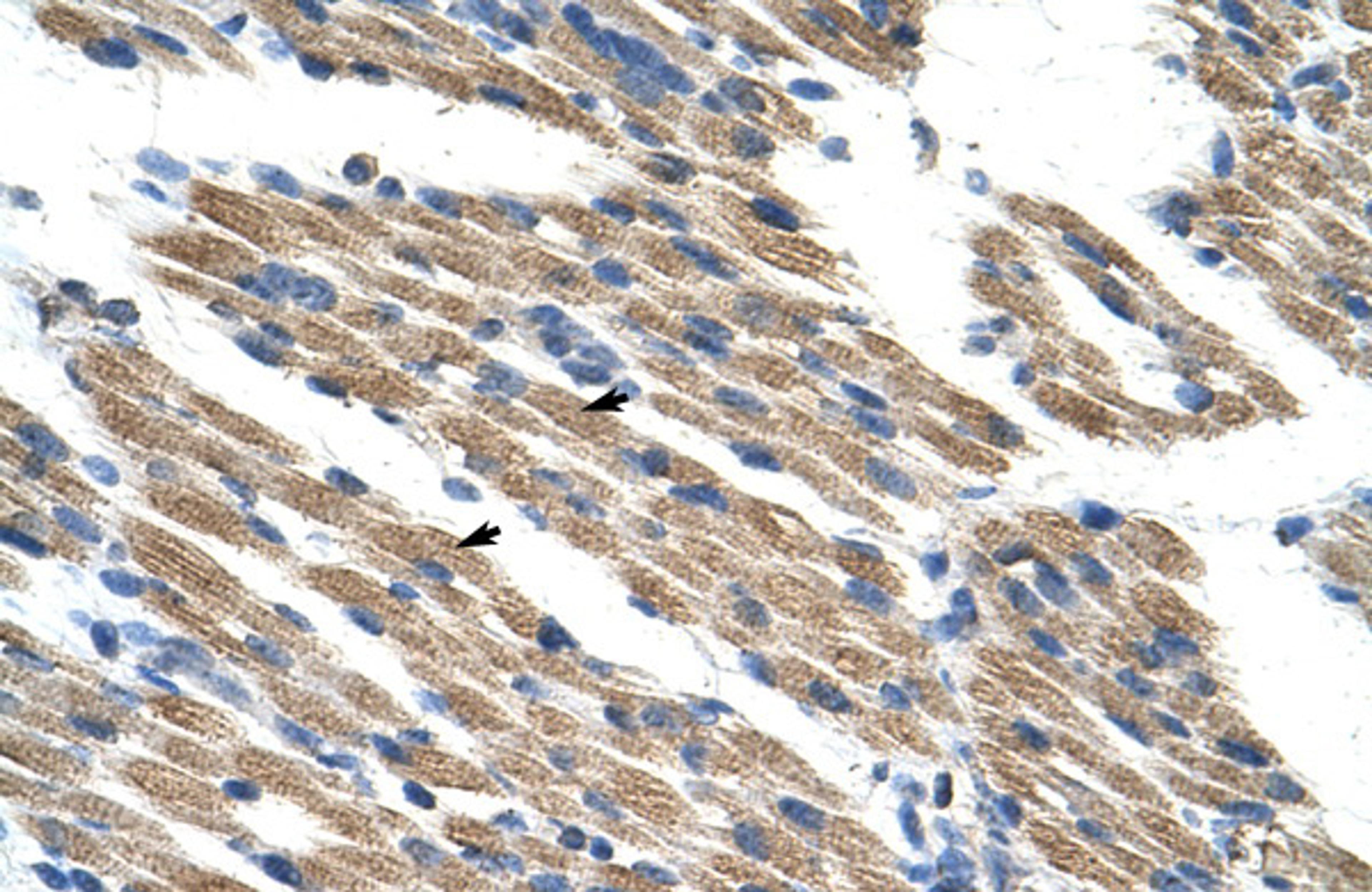 Antibody used in IHC on Human Muscle.