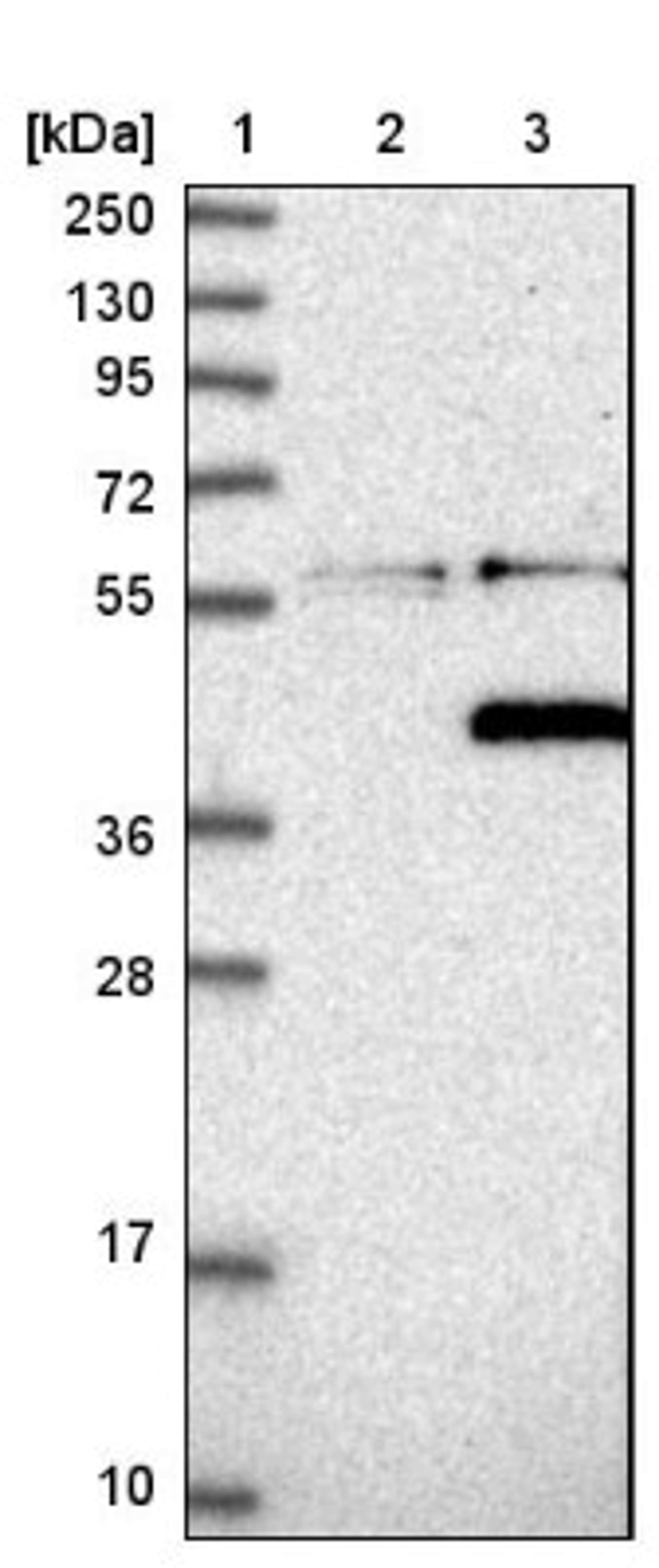 Western Blot: PPM1L Antibody [NBP1-87247] - Lane 1: Marker [kDa] 250, 130, 95, 72, 55, 36, 28, 17, 10<br/>Lane 2: Negative control (vector only transfected HEK293T lysate)<br/>Lane 3: Over-expression lysate (Co-expressed with a C-terminal myc-DDK tag (~3.1 kDa) in mammalian HEK293T cells, LY408320)