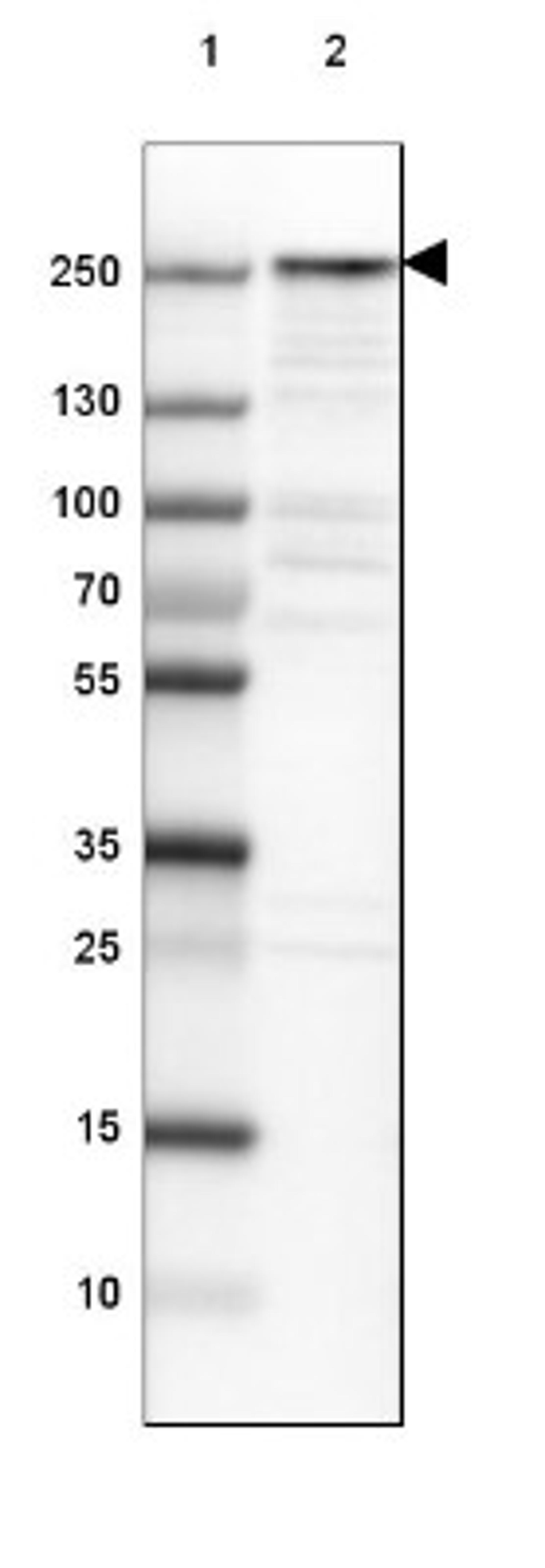 Western Blot: Scribble Antibody [NBP2-47286] - Lane 1: Marker [kDa] 250, 130, 100, 70, 55, 35, 25, 15, 10.  Lane 2: Human cell line MCF-7