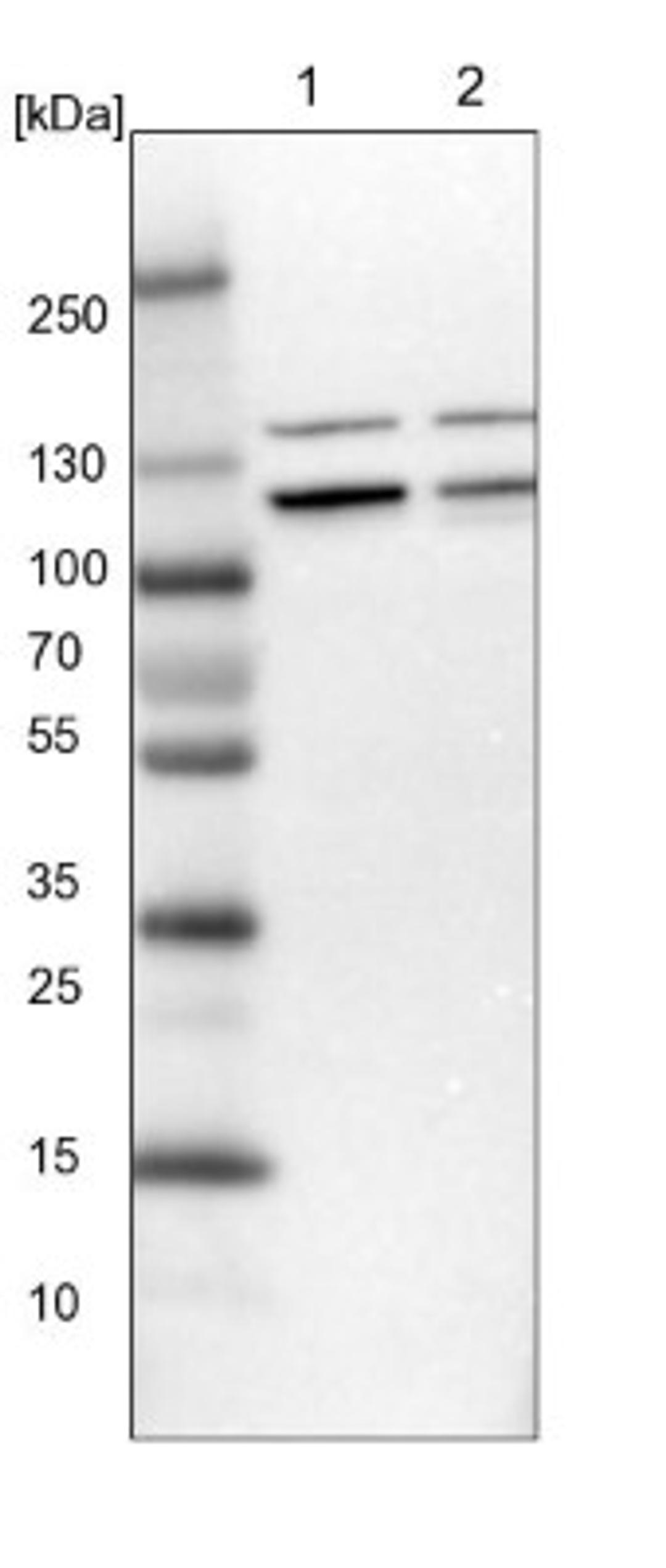 Western Blot: RABEP1 Antibody [NBP1-82588] - Lane 1: NIH-3T3 cell lysate (Mouse embryonic fibroblast cells)<br/>Lane 2: NBT-II cell lysate (Rat Wistar bladder tumour cells)