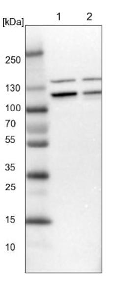 Western Blot: RABEP1 Antibody [NBP1-82588] - Lane 1: NIH-3T3 cell lysate (Mouse embryonic fibroblast cells)<br/>Lane 2: NBT-II cell lysate (Rat Wistar bladder tumour cells)