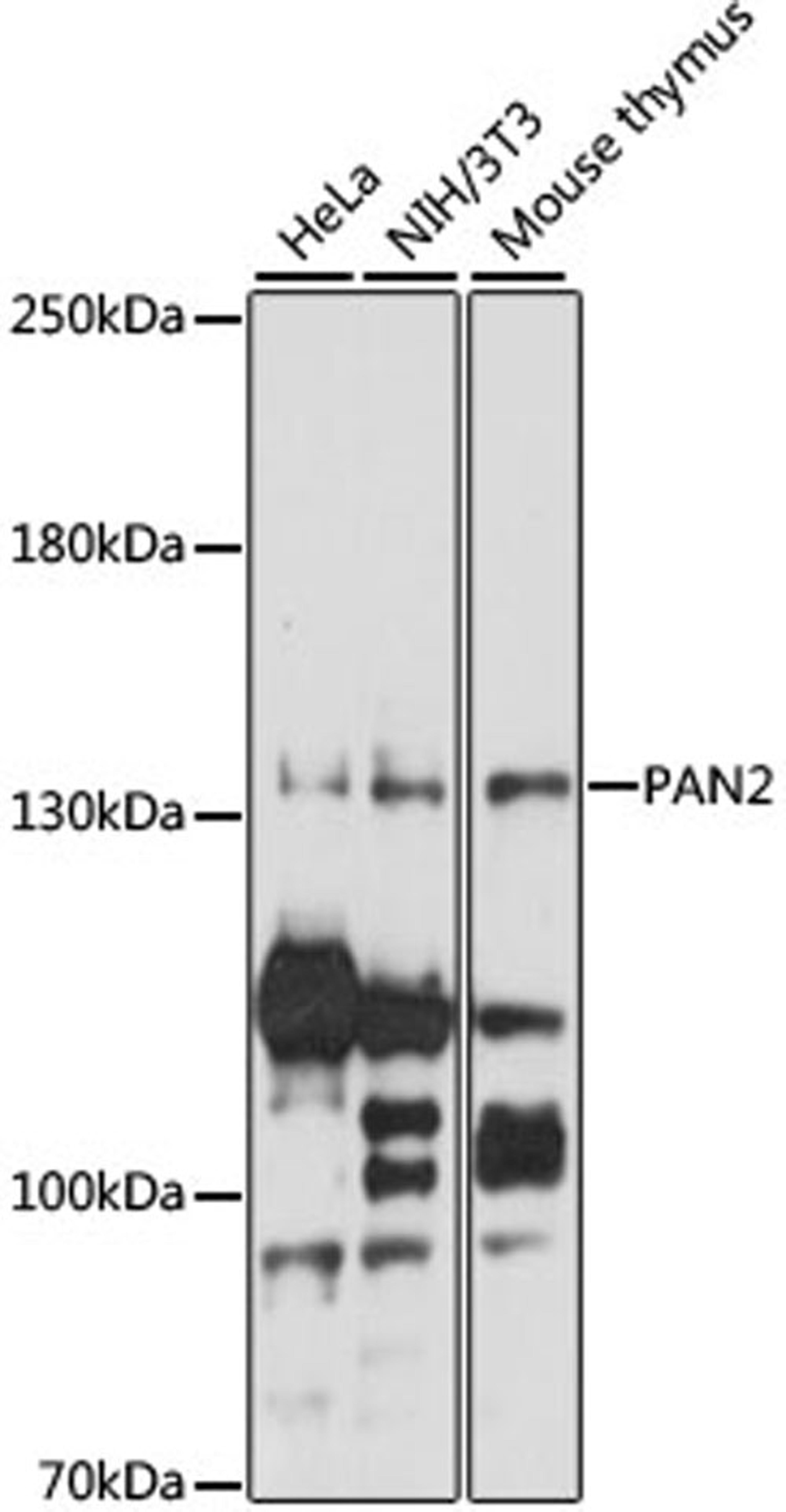 Western blot - PAN2 antibody (A15373)