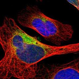 Immunocytochemistry/Immunofluorescence: DNAJB11 Antibody [NBP1-84899] - Staining of human cell line U-2 OS shows positivity in endoplasmic reticulum.