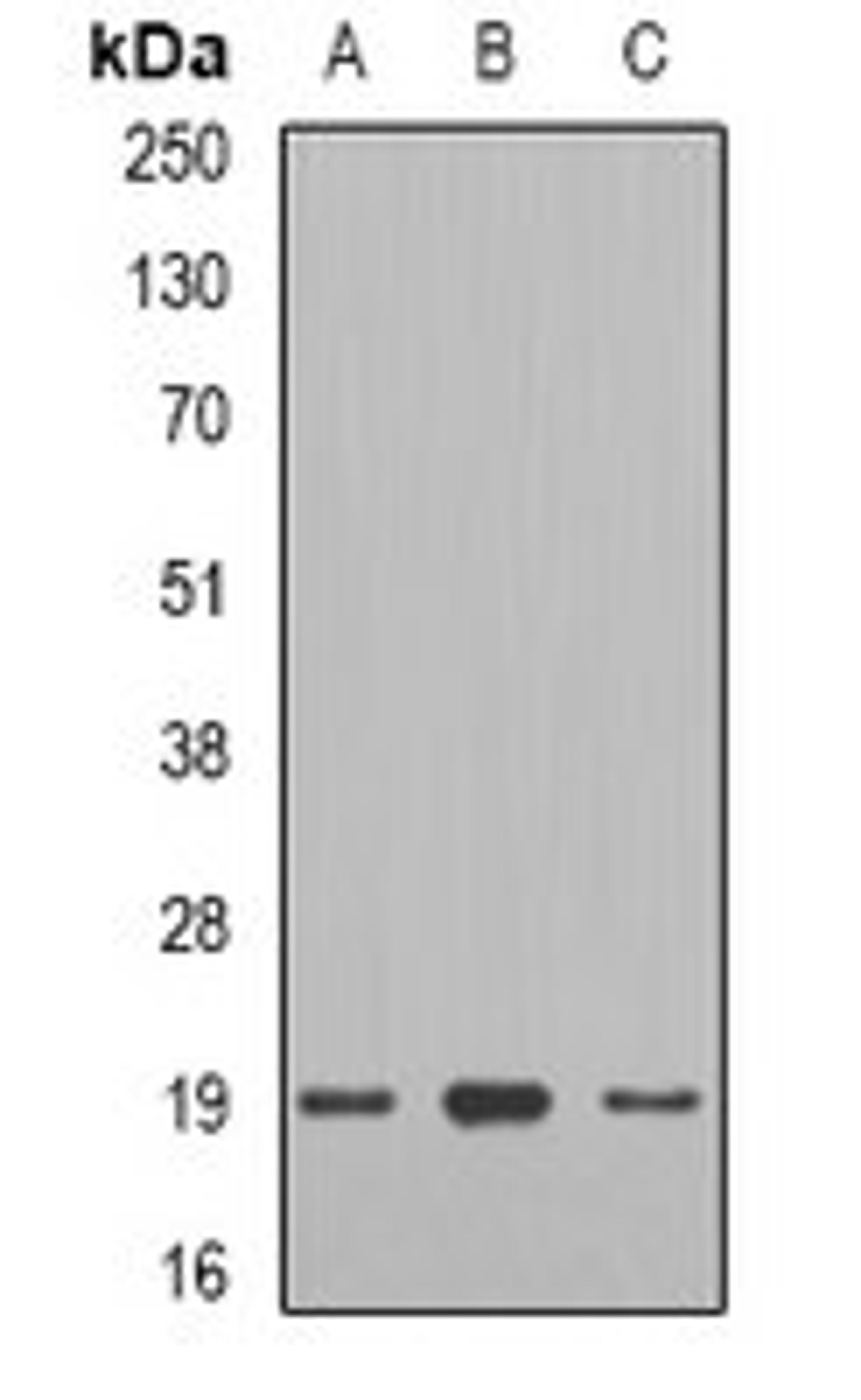 Western blot analysis of mouse heart (Lane1), rat heart (Lane2), rat skeletal muscle (Lane3) whole cell lysates using TCAP antibody