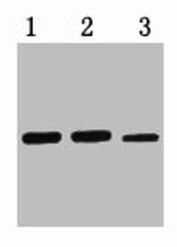 0.5ug MBP fusion protein+ Primary antibody dilution at  1) 1:3000 2) 1:5000 3) 1:10000