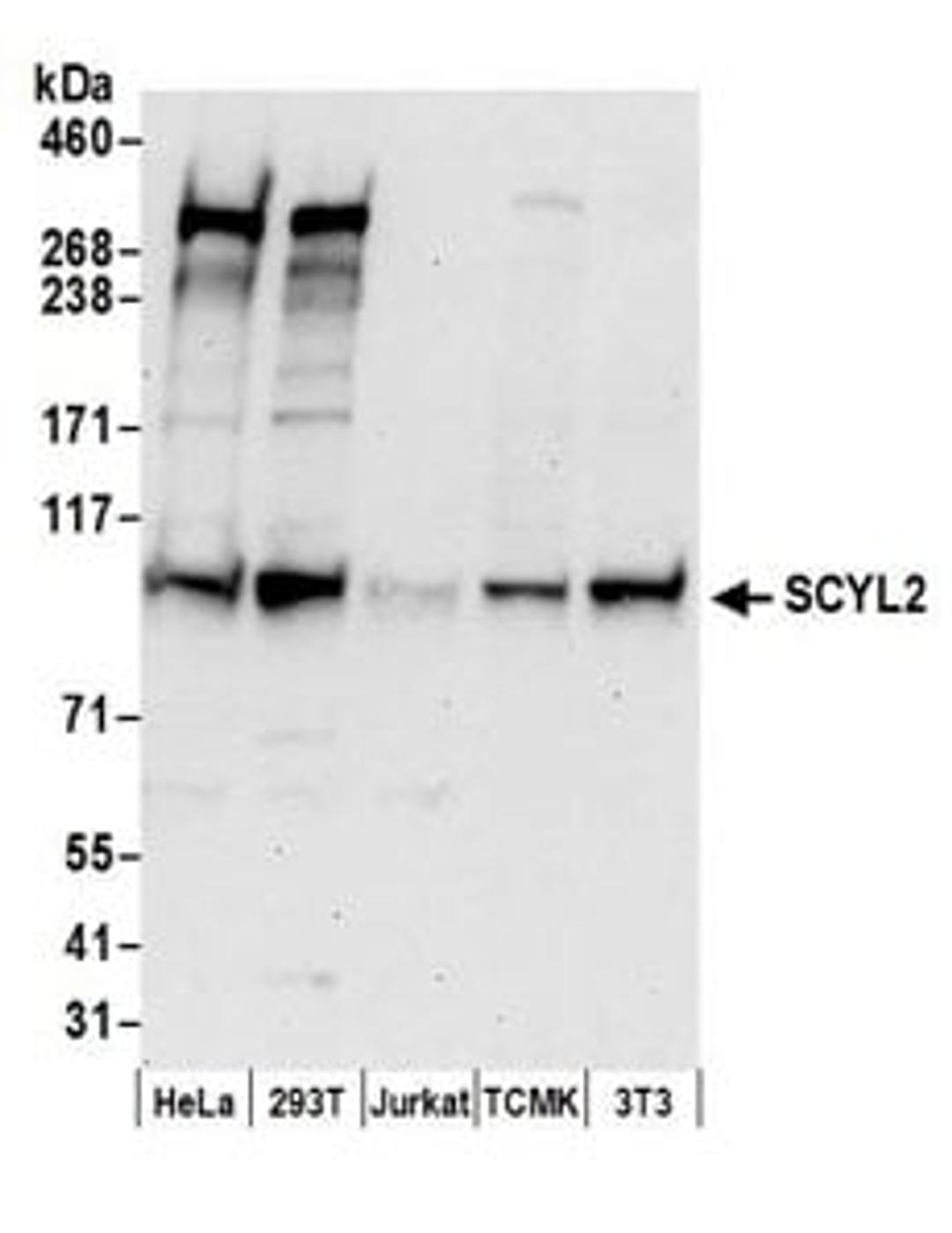 Detection of human and mouse SCYL2 by western blot.