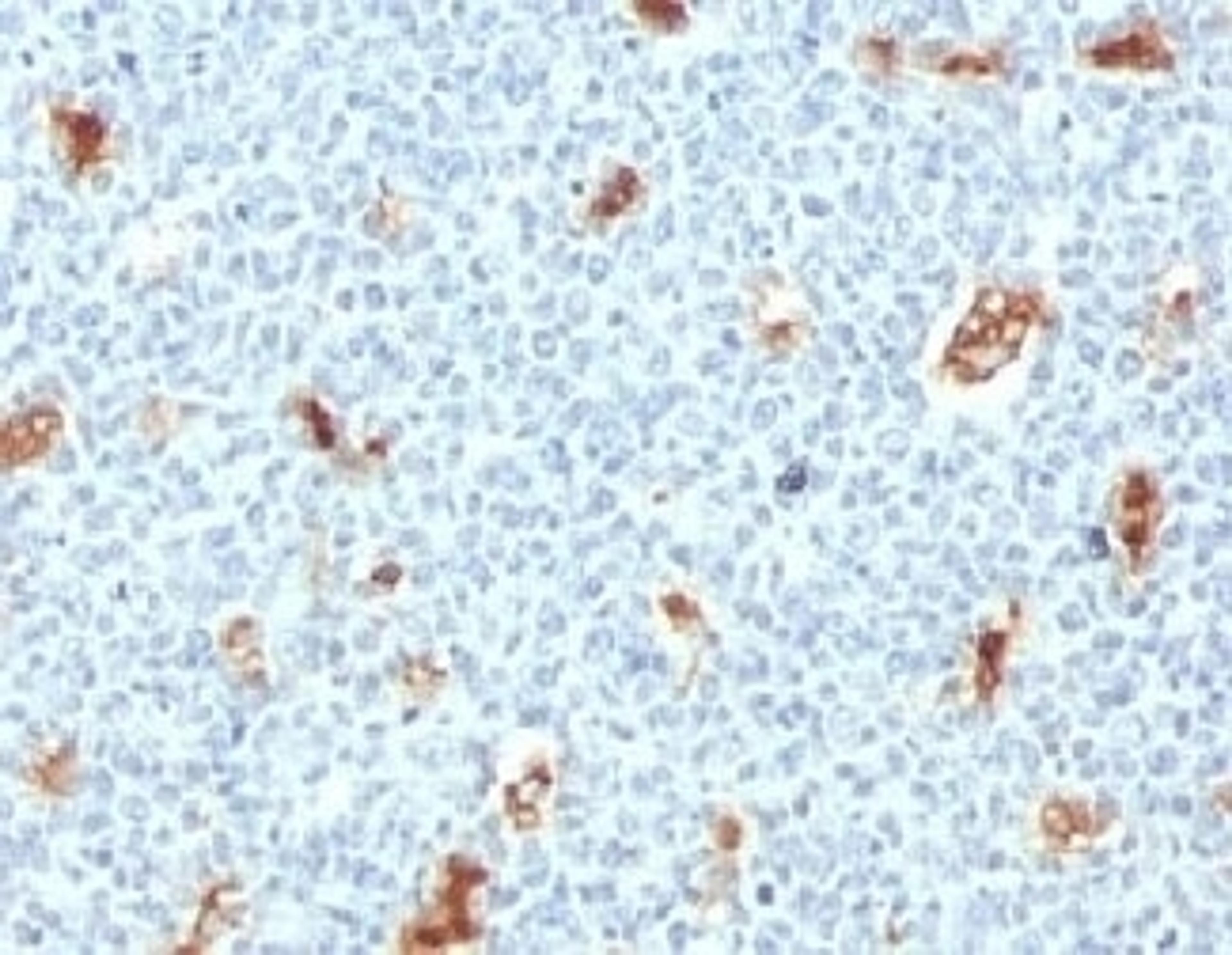 IHC testing of FFPE human tonsil with S100A9 antibody (clone PS1A9-1).