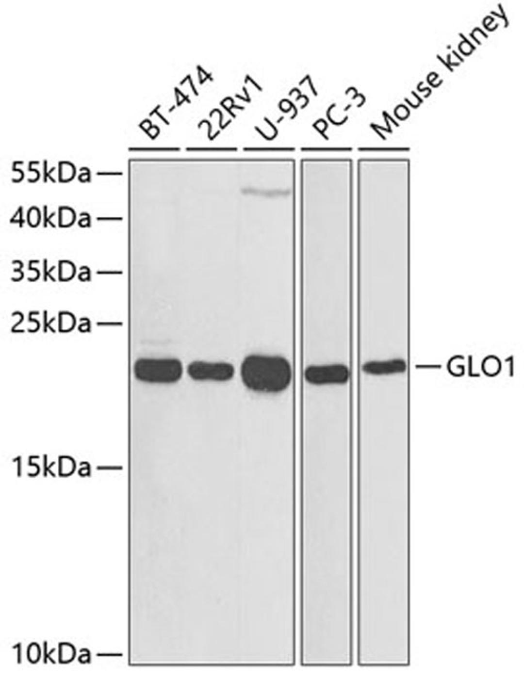 Western blot - GLO1 antibody (A1932)