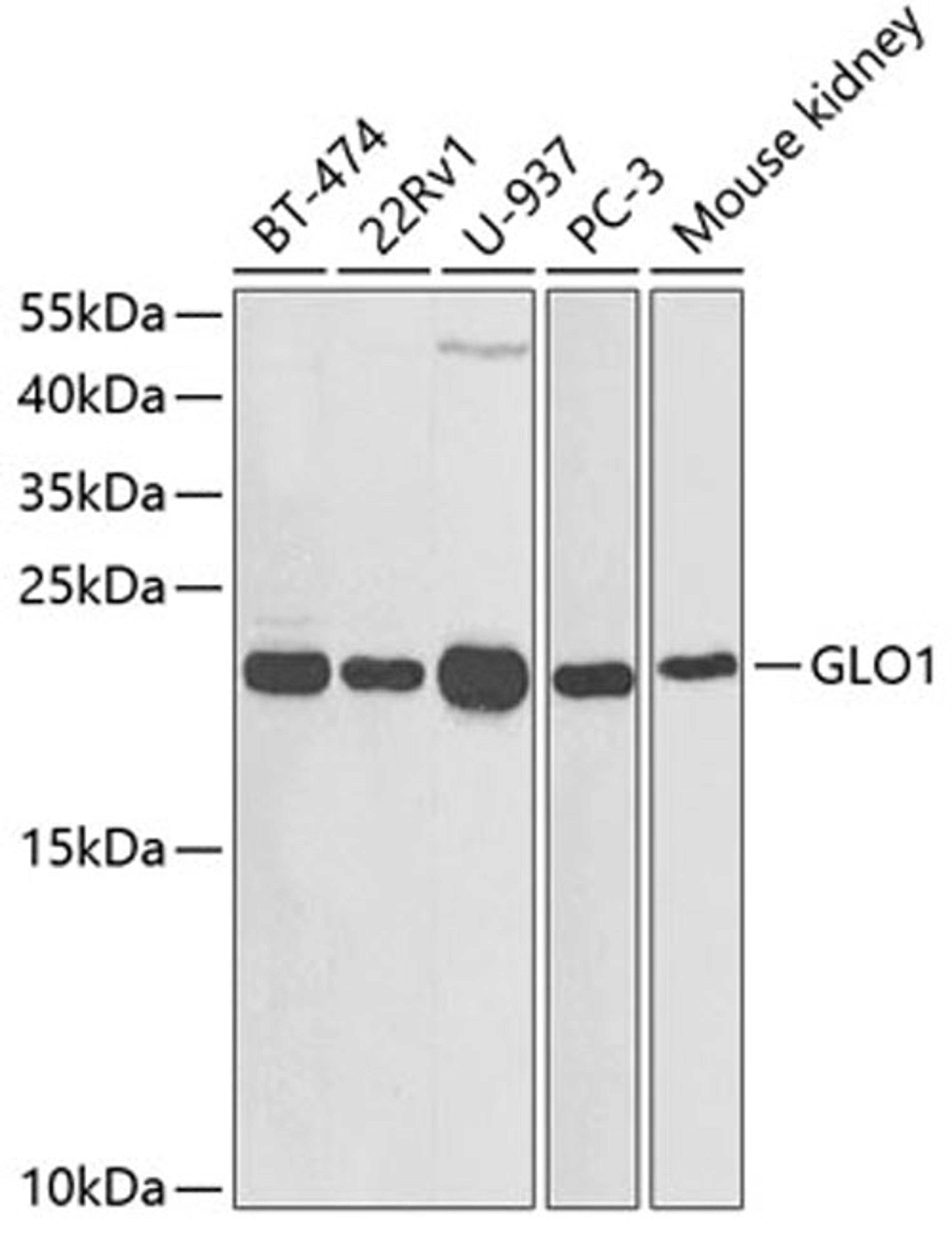 Western blot - GLO1 antibody (A1932)