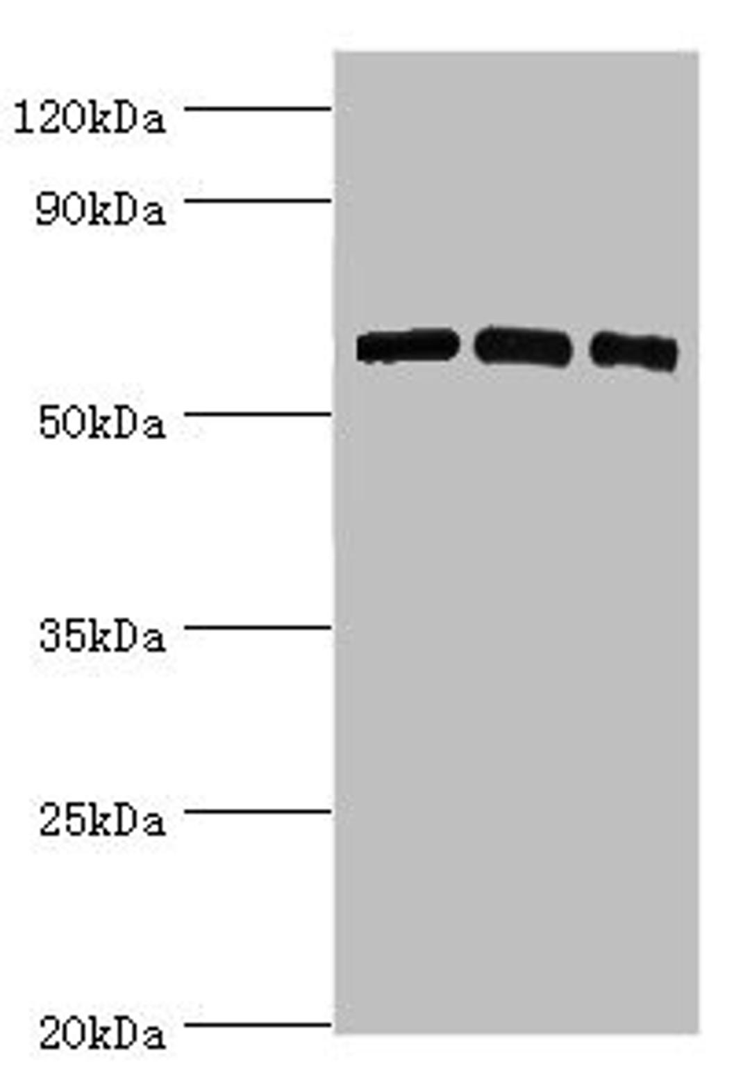 Western blot. All lanes: PRKAA2 antibody at 8ug/ml. Lane 1: Hela whole cell lysate. Lane 2: K562 whole cell lysate. Lane 3: MCF-7 whole cell lysate. Secondary. Goat polyclonal to rabbit IgG at 1/10000 dilution. Predicted band size: 62 kDa. Observed band size: 62 kDa. 