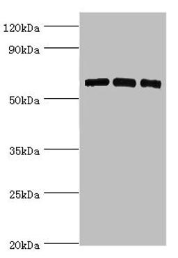 Western blot. All lanes: PRKAA2 antibody at 8ug/ml. Lane 1: Hela whole cell lysate. Lane 2: K562 whole cell lysate. Lane 3: MCF-7 whole cell lysate. Secondary. Goat polyclonal to rabbit IgG at 1/10000 dilution. Predicted band size: 62 kDa. Observed band size: 62 kDa. 