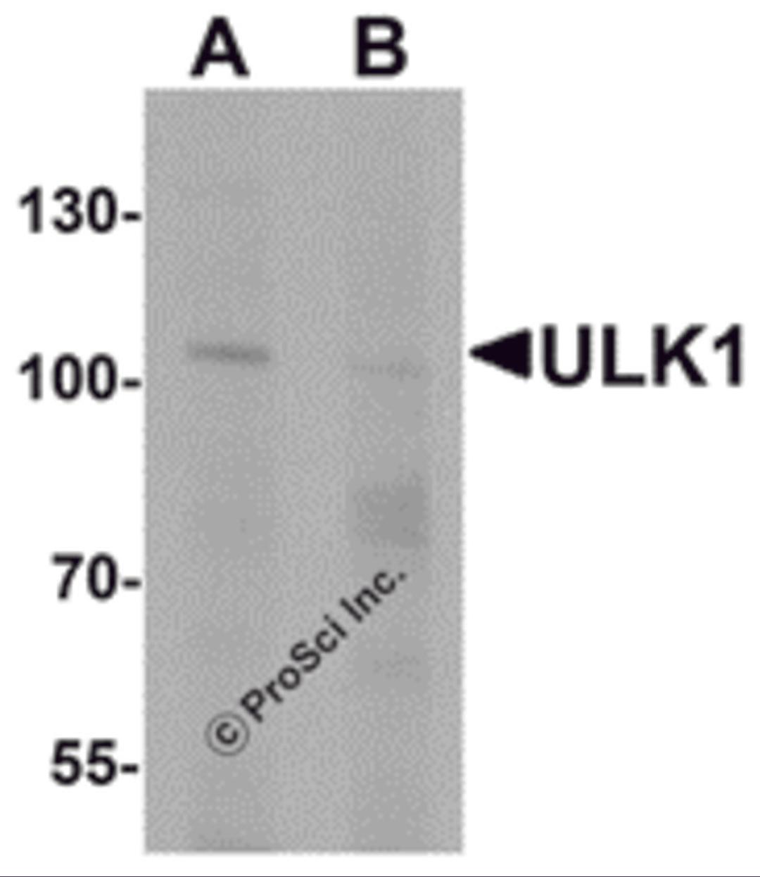 Western blot analysis of ULK1 in rat brain tissue lysate with ULK1 antibody at 1 μg/mL in (A) the absence and (B) the presence of blocking peptide.