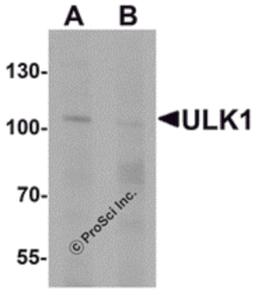 Western blot analysis of ULK1 in rat brain tissue lysate with ULK1 antibody at 1 μg/mL in (A) the absence and (B) the presence of blocking peptide.