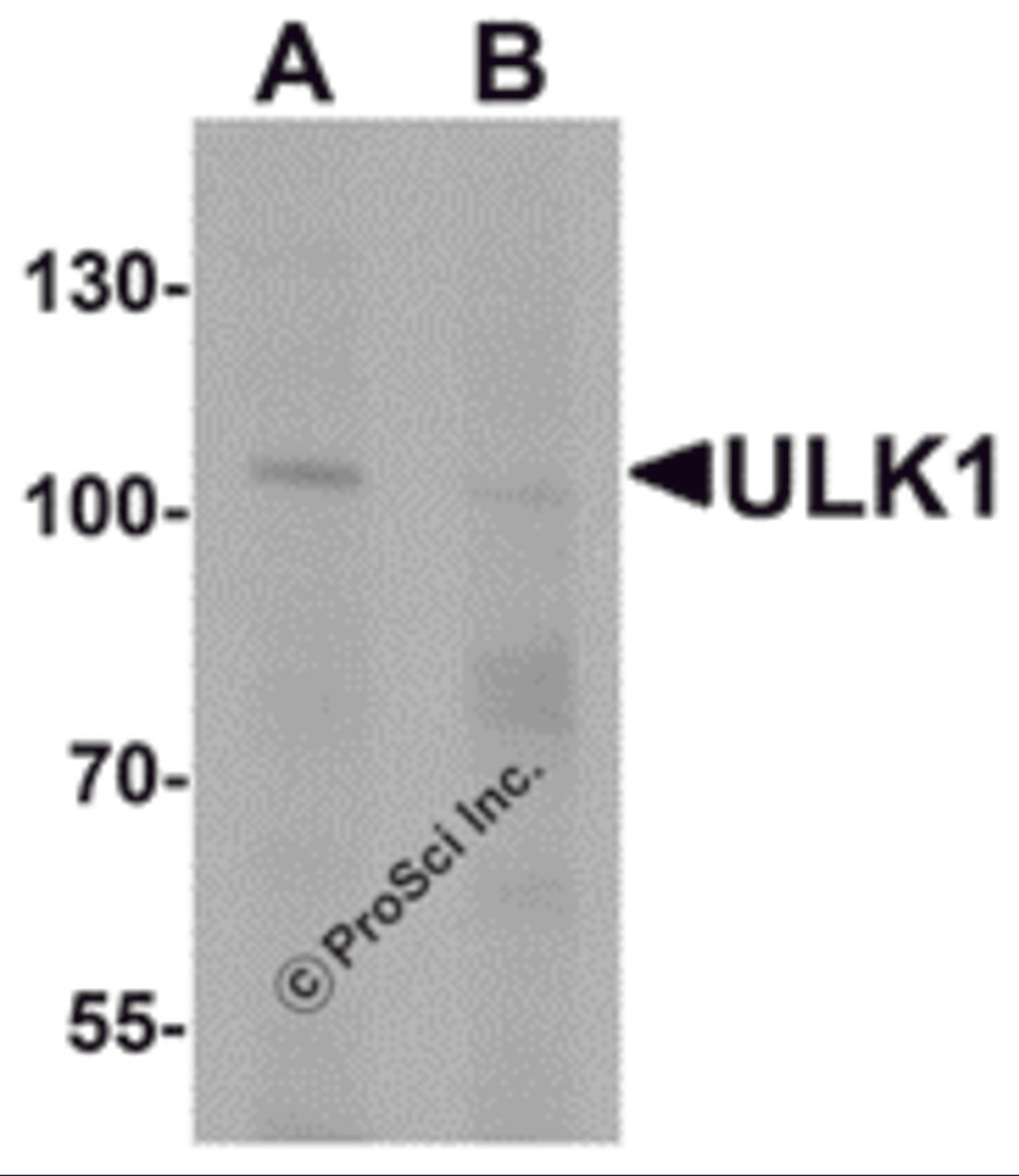 Western blot analysis of ULK1 in rat brain tissue lysate with ULK1 antibody at 1 μg/mL in (A) the absence and (B) the presence of blocking peptide.