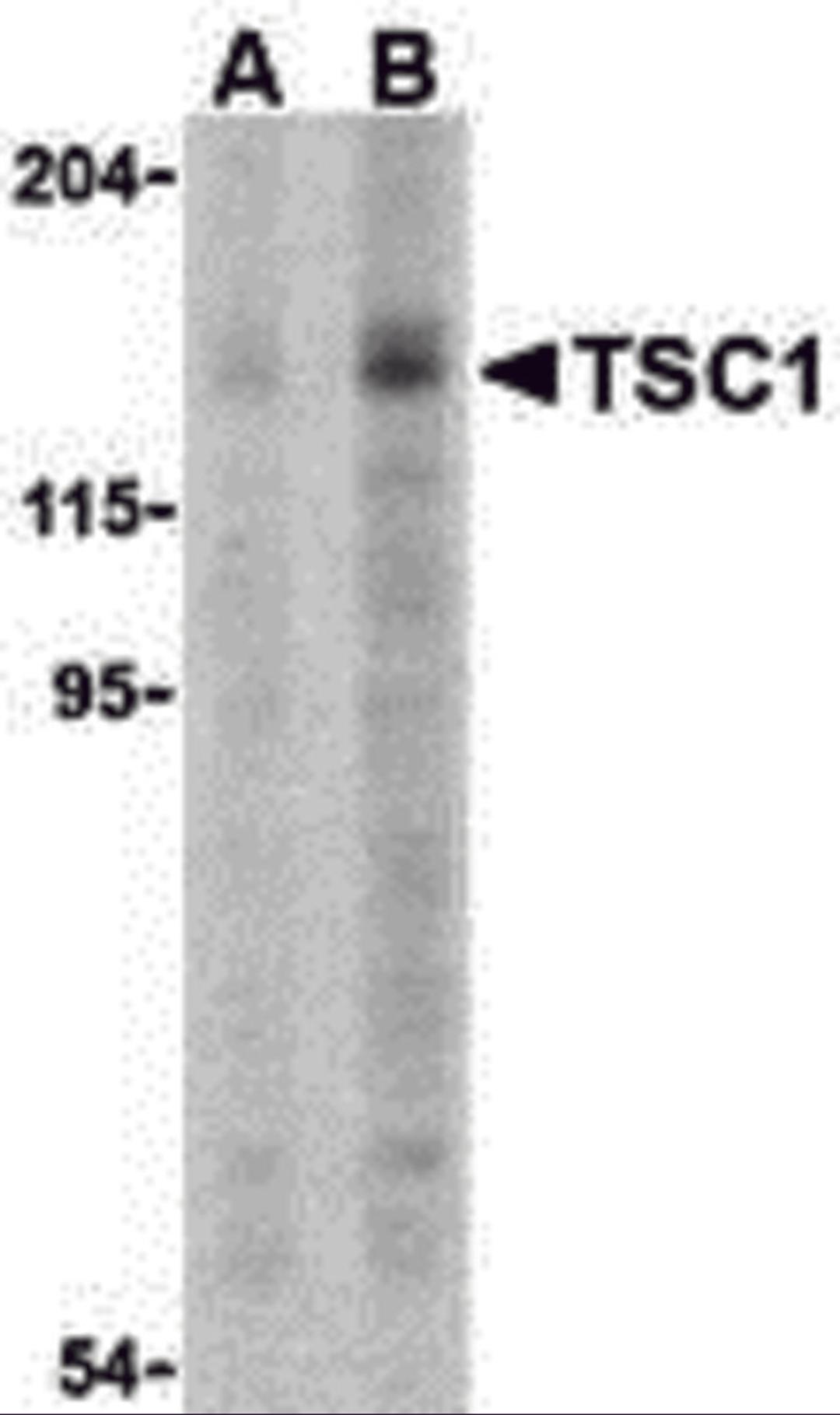 Western blot analysis of TSC1 in C2C12 cell lysate with TSC1 antibody at (A) 2 and (B) 4 μg.