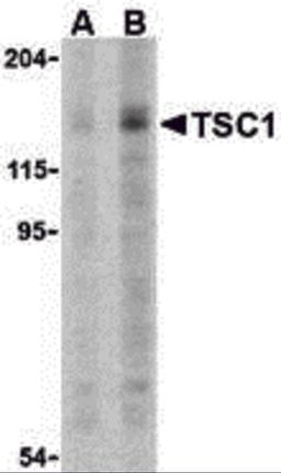 Western blot analysis of TSC1 in C2C12 cell lysate with TSC1 antibody at (A) 2 and (B) 4 μg.