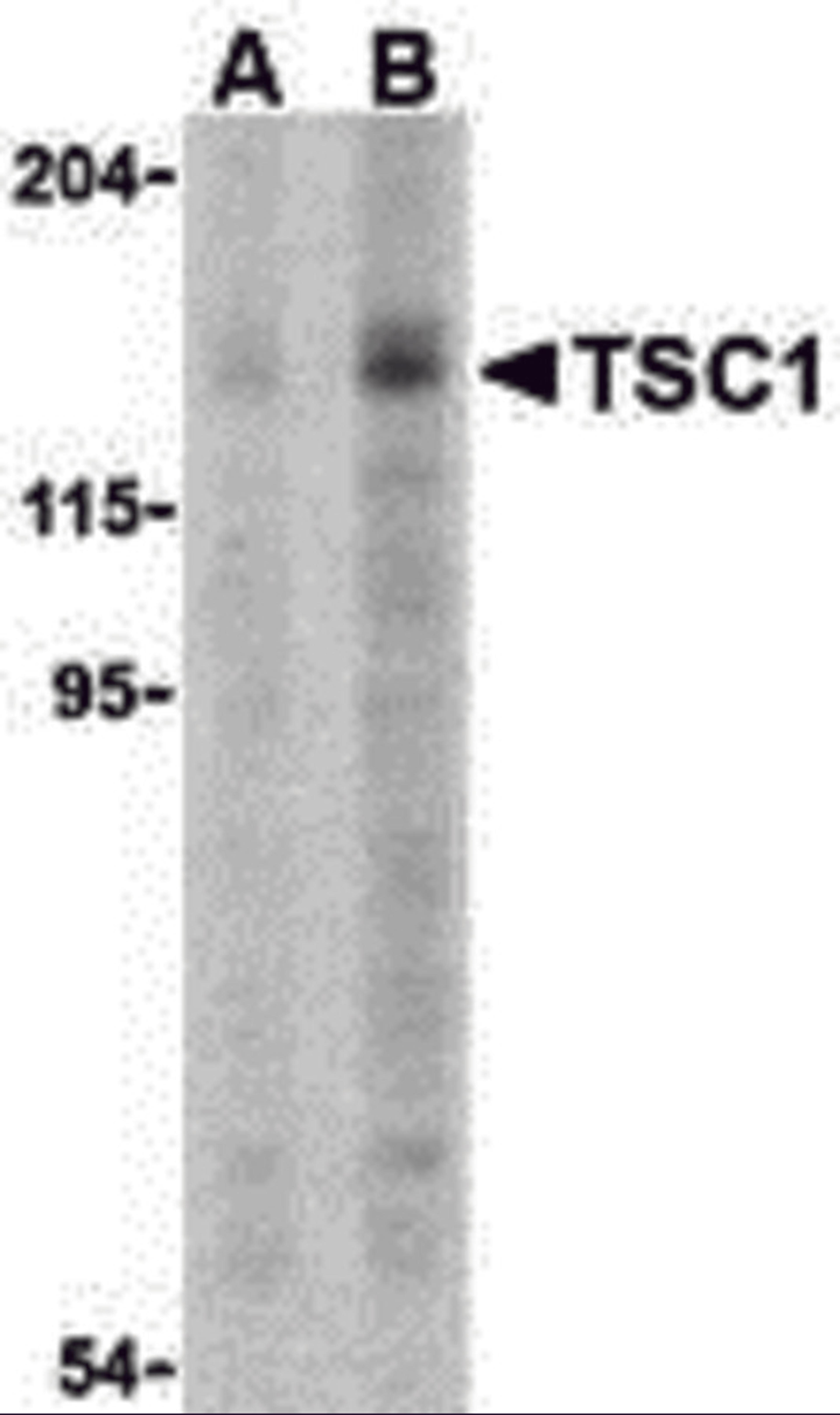Western blot analysis of TSC1 in C2C12 cell lysate with TSC1 antibody at (A) 2 and (B) 4 μg.