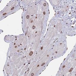 Immunohistochemistry: ZBTB1 Antibody [NBP2-31022] - Immunohistochemical staining of human heart muscle shows strong nuclear membranous positivity in myocytes.