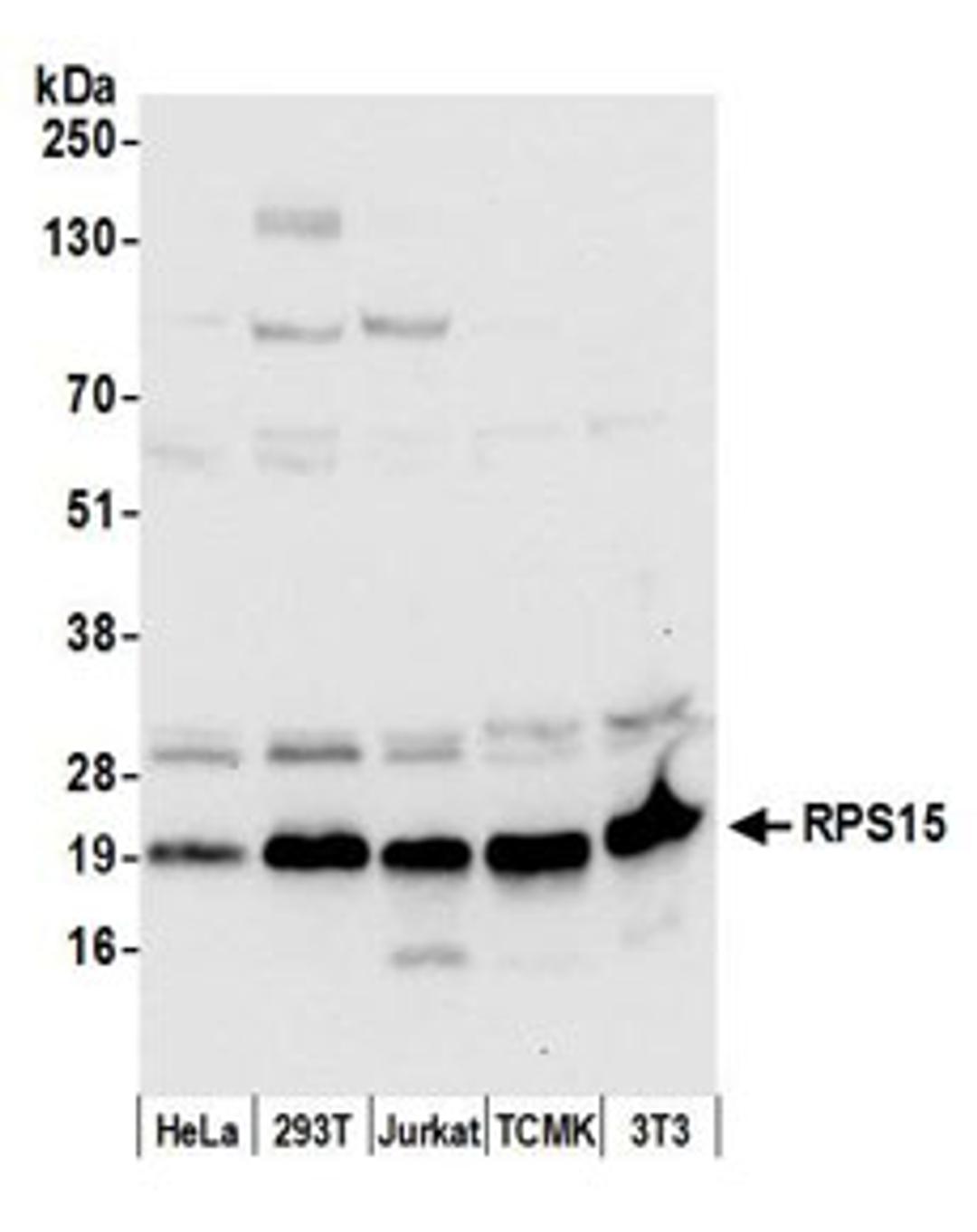 Detection of human and mouse RPS15 by western blot.