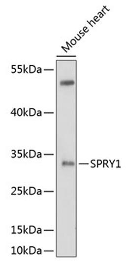 Western blot - SPRY1 antibody (A10278)