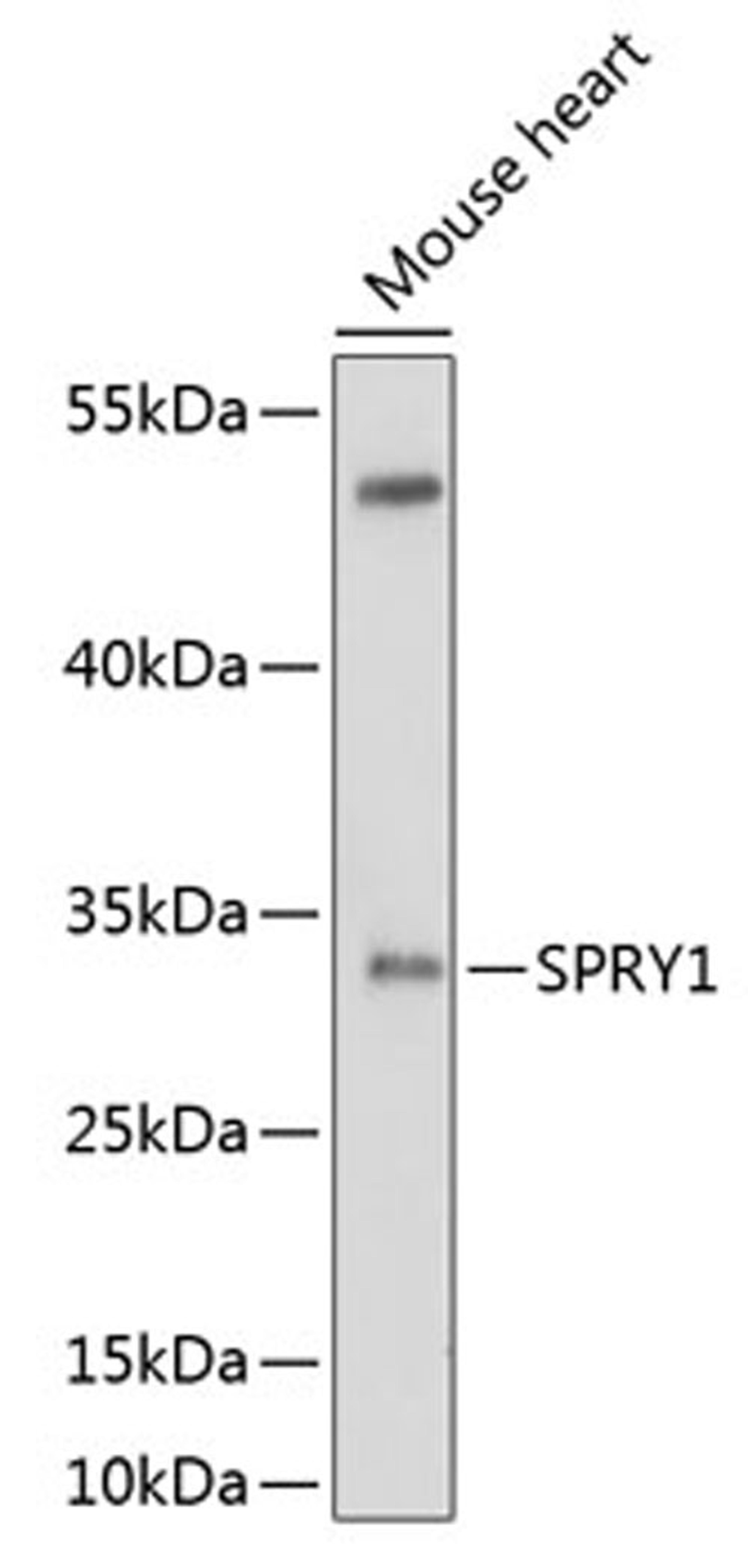 Western blot - SPRY1 antibody (A10278)