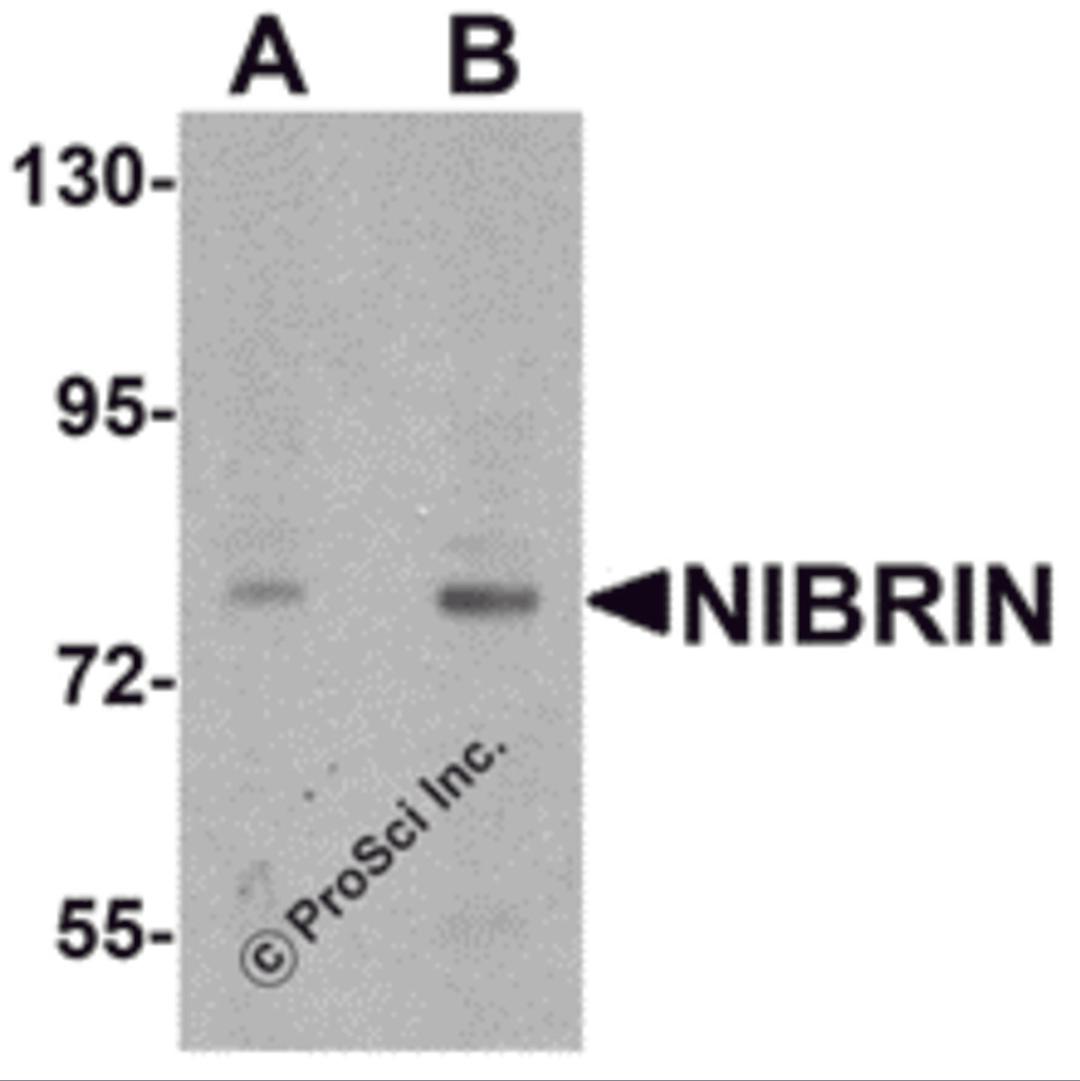 Western blot analysis of NIBRIN in rat lung tissue lysate with NIBRIN antibody at (A) 1 and (B) 2 μg/mL.