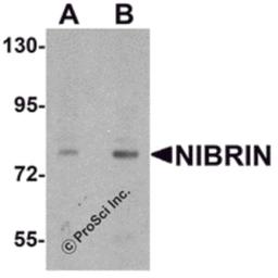 Western blot analysis of NIBRIN in rat lung tissue lysate with NIBRIN antibody at (A) 1 and (B) 2 μg/mL.