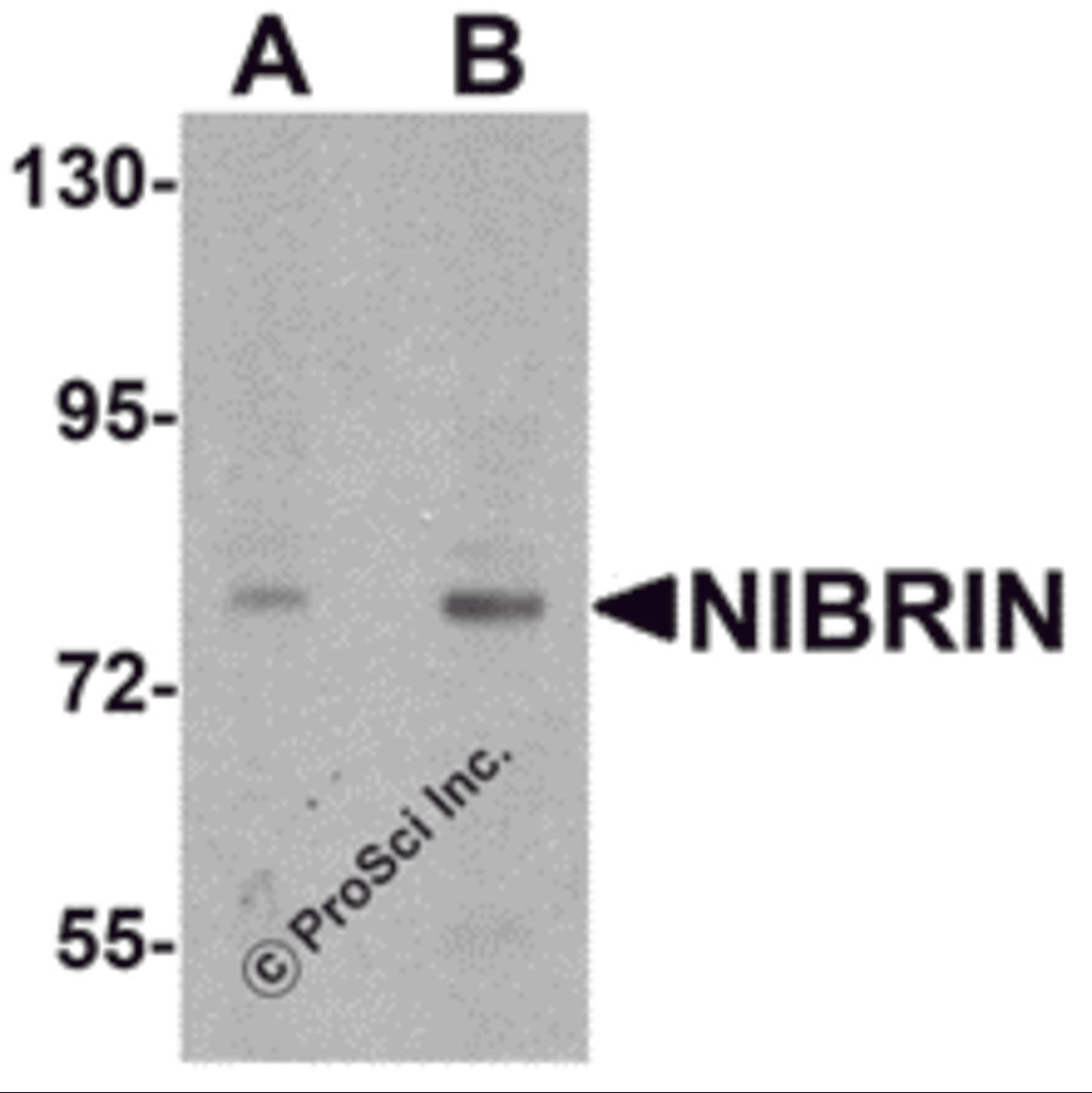Western blot analysis of NIBRIN in rat lung tissue lysate with NIBRIN antibody at (A) 1 and (B) 2 μg/mL.