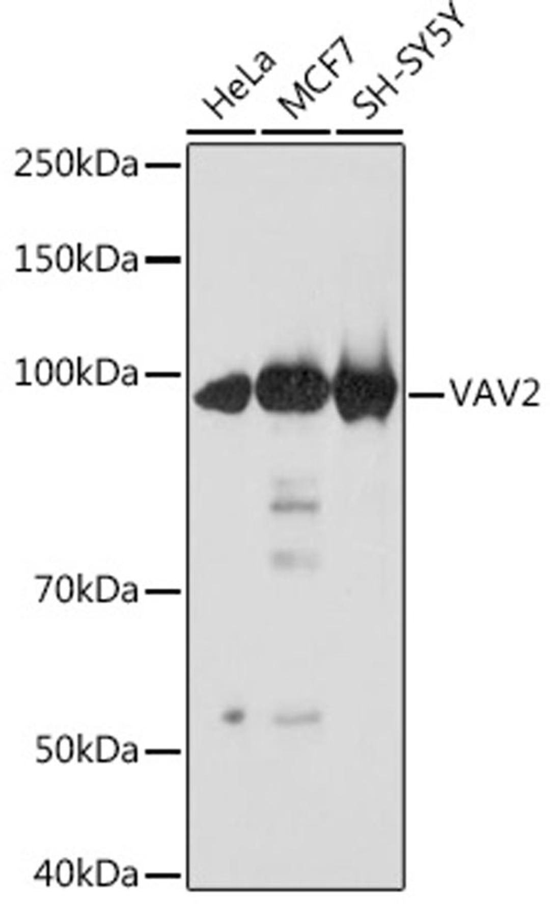Western blot - VAV2 Rabbit mAb (A3548)