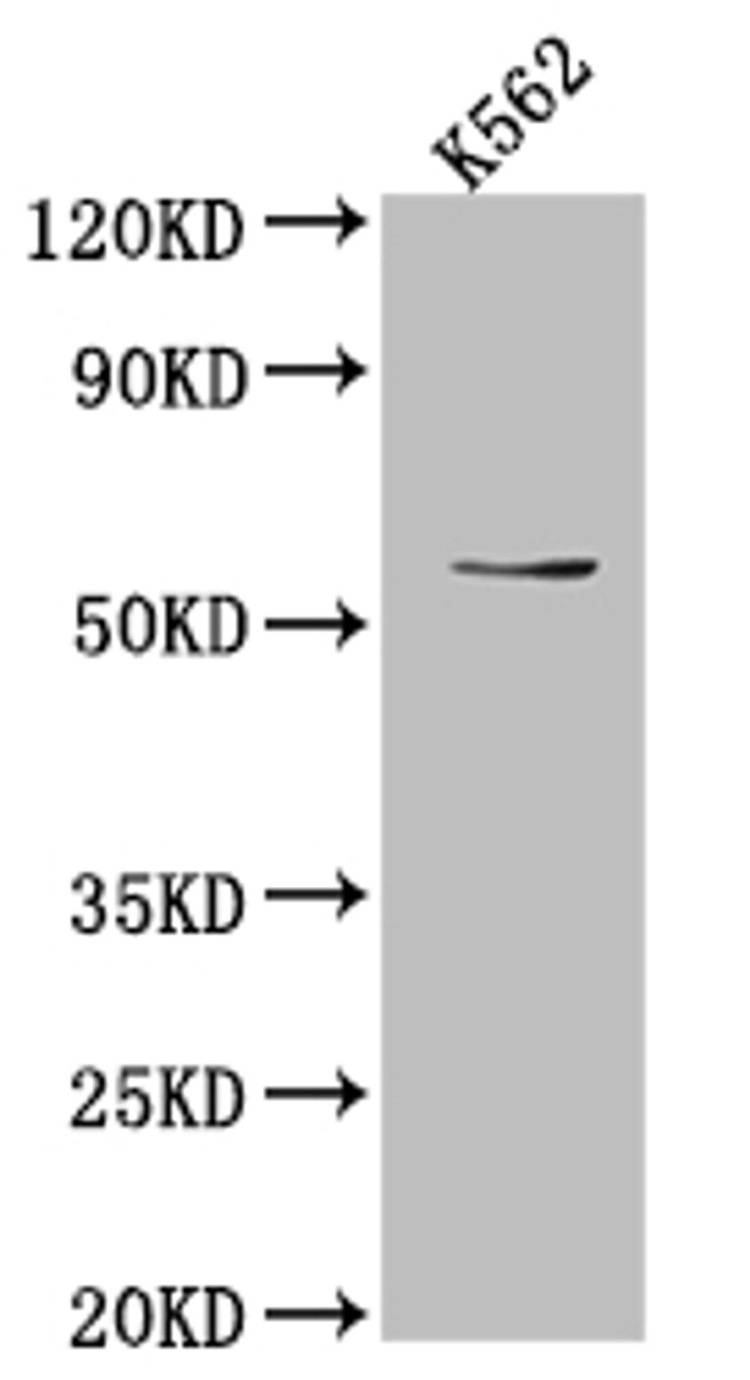Western Blot. Positive WB detected in: K562 whole cell lysate. All lanes: UAP1 antibody at 1:1000. Secondary. Goat polyclonal to rabbit IgG at 1/50000 dilution. Predicted band size: 59, 58, 59 kDa. Observed band size: 59 kDa. 