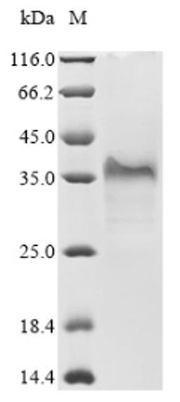 (Tris-Glycine gel) Discontinuous SDS-PAGE (reduced) with 5% enrichment gel and 15% separation gel.