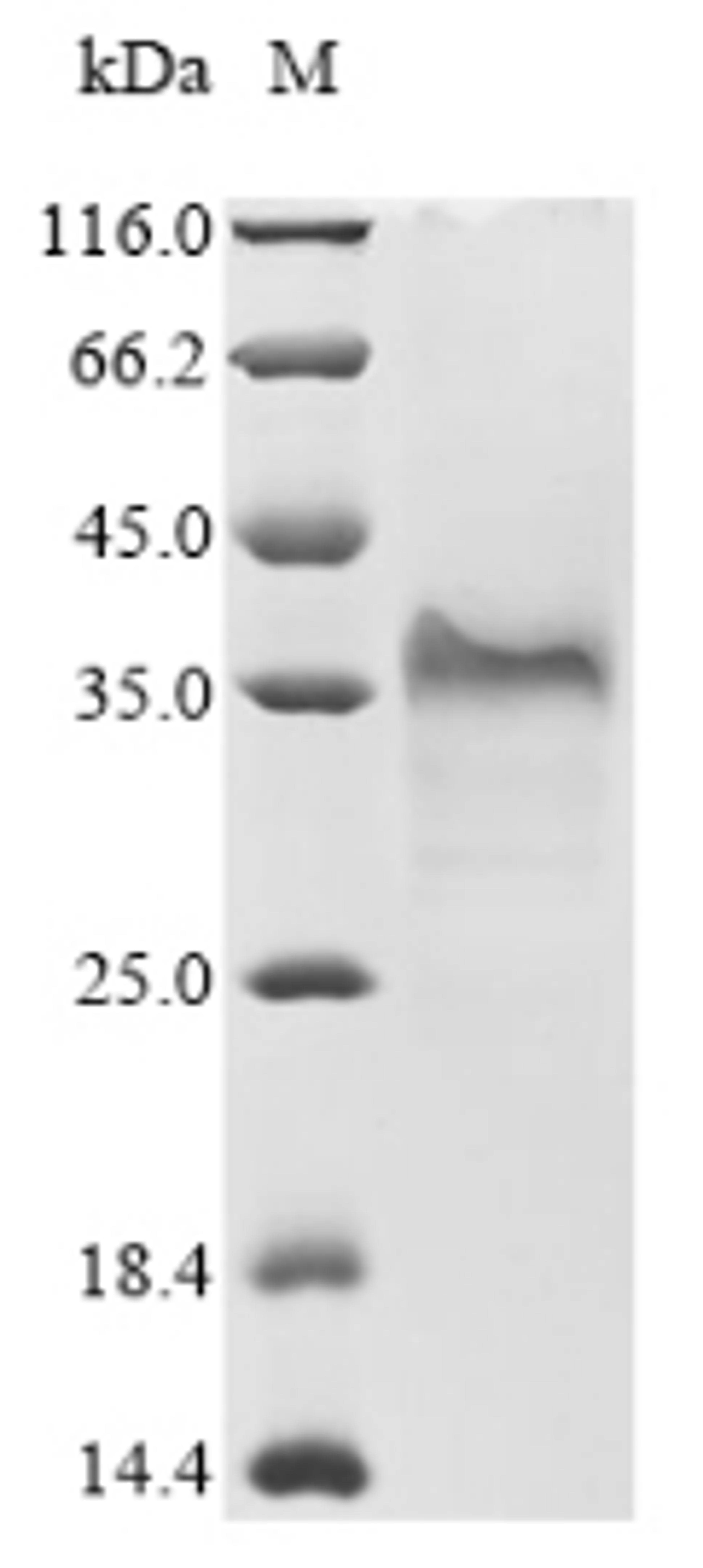 (Tris-Glycine gel) Discontinuous SDS-PAGE (reduced) with 5% enrichment gel and 15% separation gel.