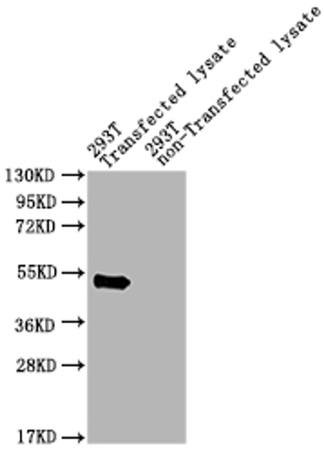 Western Blot. Positive WB detected in: pat 293T Transfected lysate, 293T non-Transfected lysate. All lanes: pat antibody at 1:2000. Secondary. Goat polyclonal to rabbit IgG at 1/50000 dilution. Predicted band size: 49 kDa. Observed band size: 49 kDa.