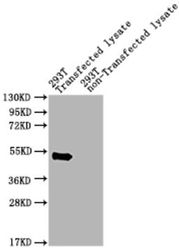 Western Blot. Positive WB detected in: pat 293T Transfected lysate, 293T non-Transfected lysate. All lanes: pat antibody at 1:2000. Secondary. Goat polyclonal to rabbit IgG at 1/50000 dilution. Predicted band size: 49 kDa. Observed band size: 49 kDa.