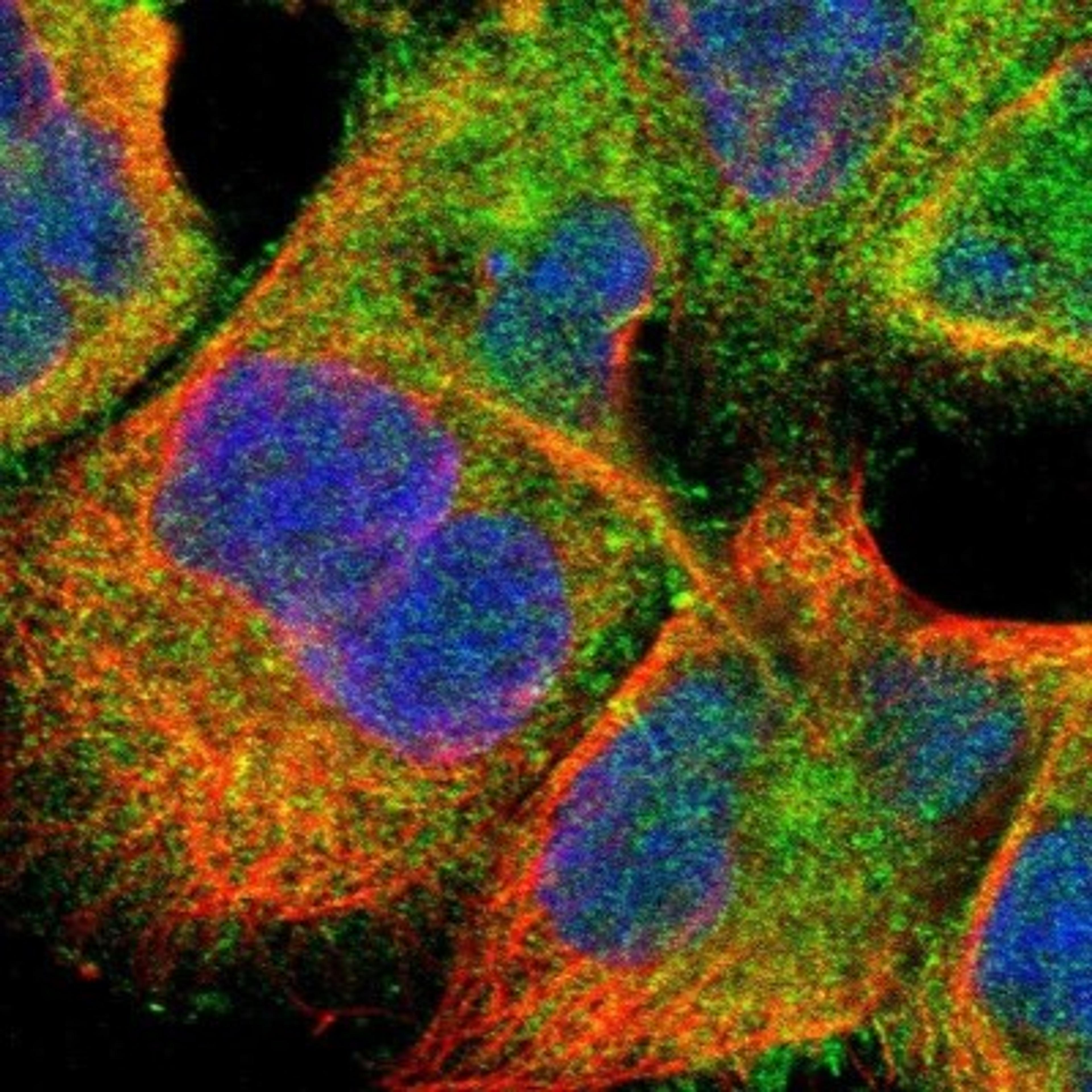 Immunocytochemistry/Immunofluorescence: PCTAIRE1 Antibody [NBP1-92248] - Staining of human cell line A-431 shows positivity in plasma membrane & cytoplasm.