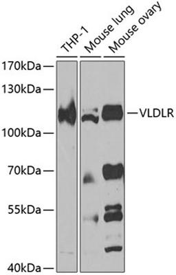 Western blot - VLDLR antibody (A7345)