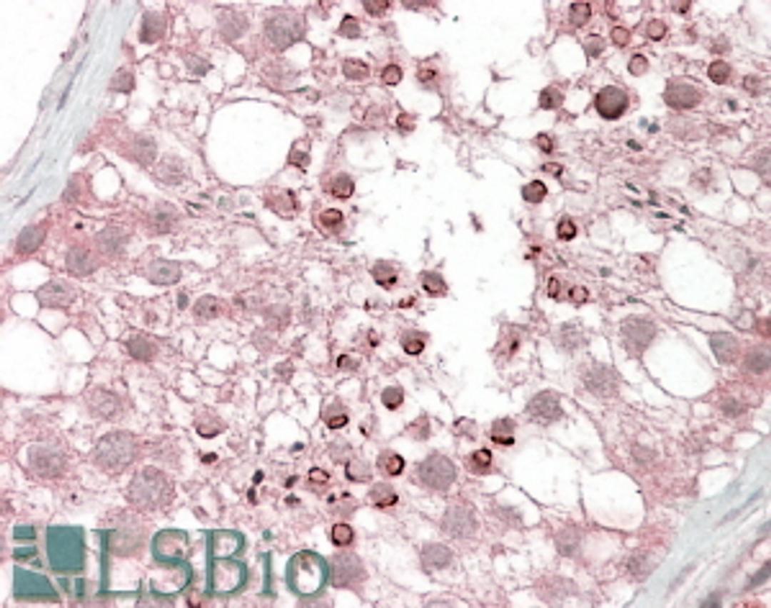 46-562 (3.8ug/ml) staining of paraffin embedded Human Testis. Steamed antigen retrieval with citrate buffer pH 6, AP-staining.